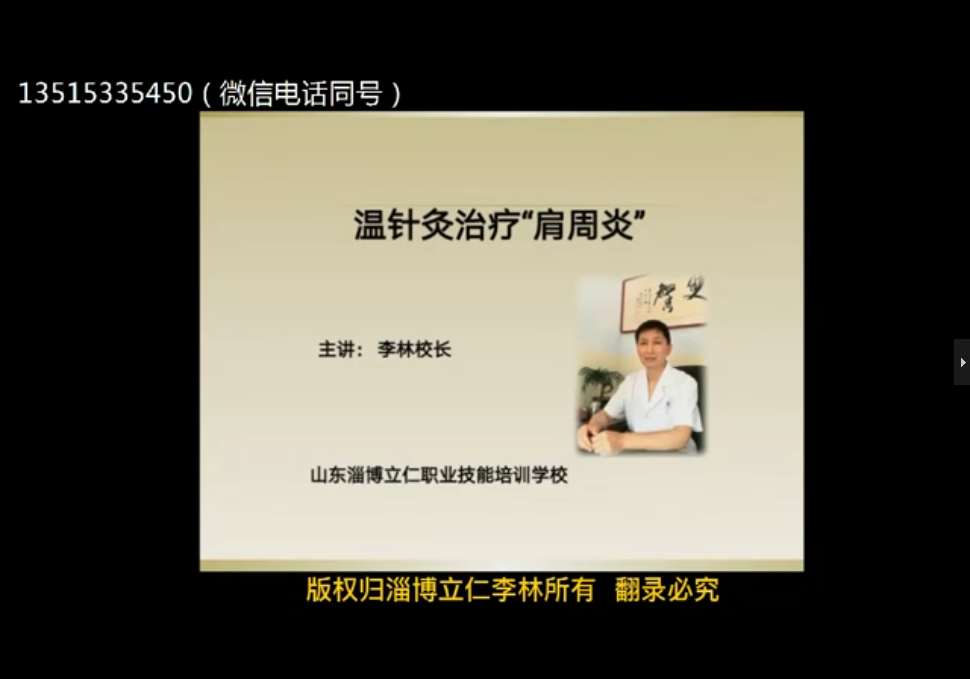 “靶向针灸”治疗肩周炎