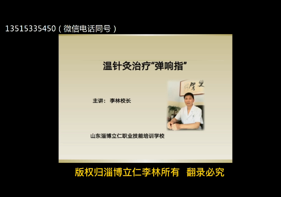 “靶向针灸”治疗弹响指