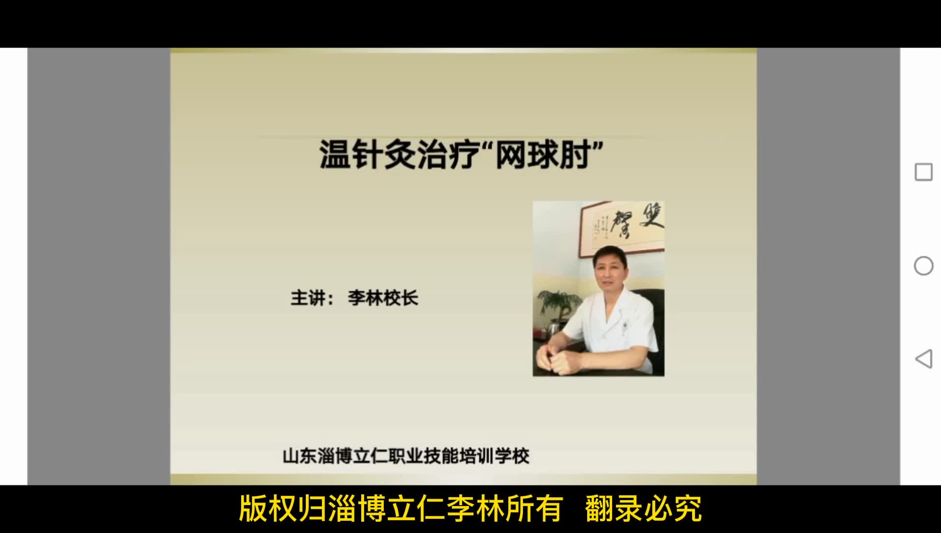 “靶向针灸”治疗网球肘