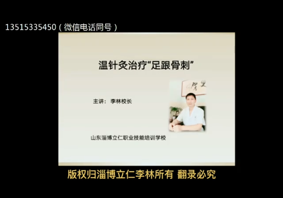 “靶向针灸”治疗足跟骨刺